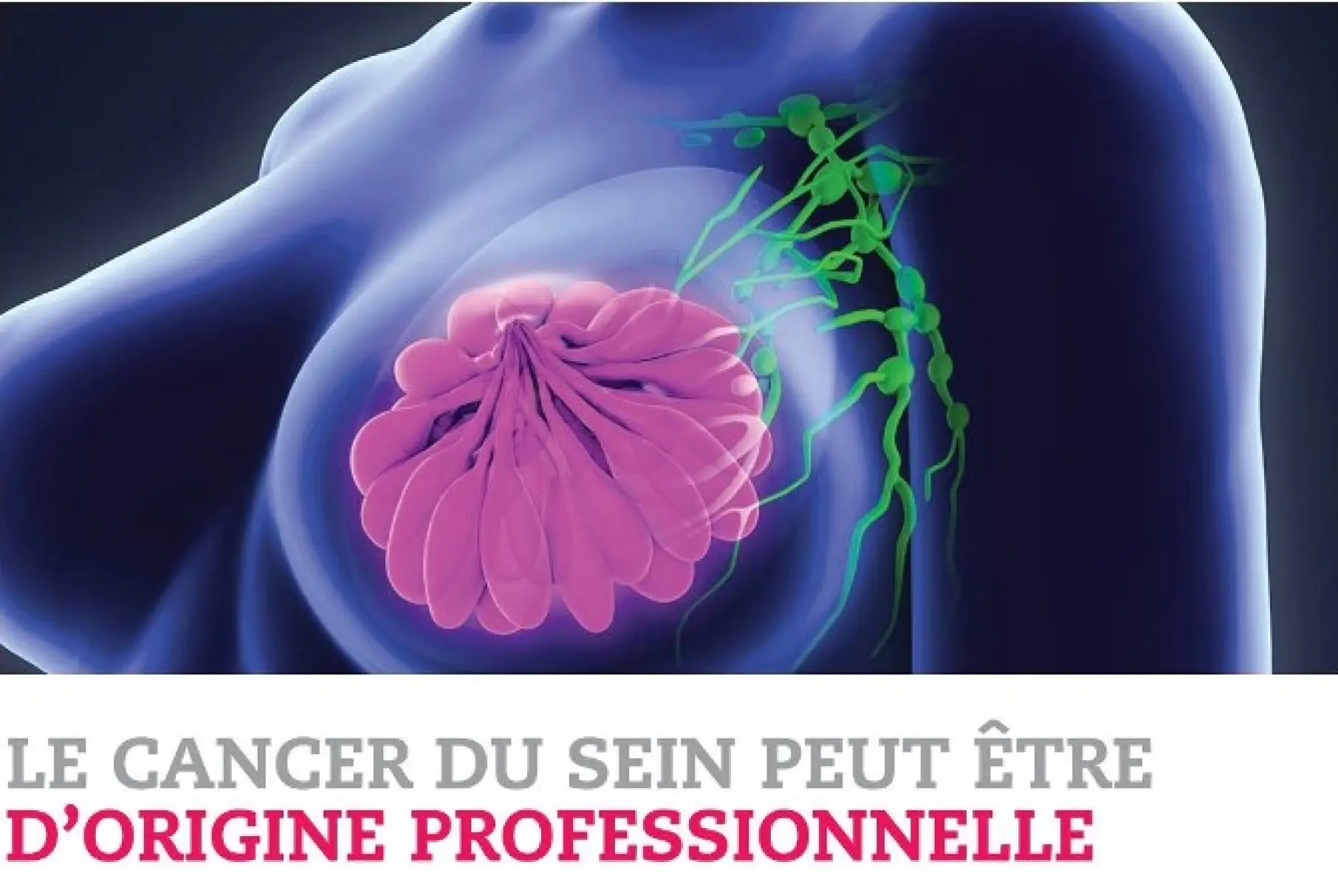 Travail de nuit et cancer du sein : une décision historique du tribunal administratif de Marseille